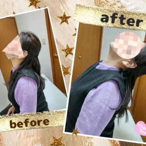 Before/After 【仙台市 O様】